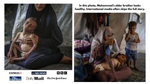 In_a_photo_Mohammeds_older_brother_looks_healthy_prompting_questions._Their_mother_says_Mohammed_has_a_muscle_disorder_needing_ongoing_therapy_and_special_nutrition._1